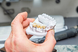 Model smile with dental bridge