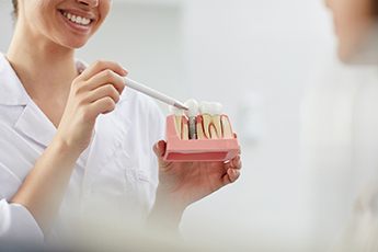 Implant dentist holding dental implant model