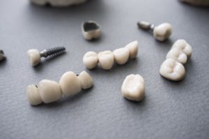 A pile of dental restorations.