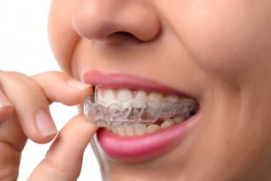 woman putting her Invisalign aligners in her mouth