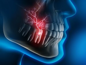 an image of a mouth with pain radiating from a tooth